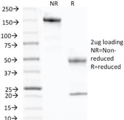 p57 Kip2 Antibody (KP10), Novus Biologicals 0.2mg; Unlabeled:Antibodies,